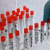 Швейцарские учёные заявили, что уже к октябрю будет готова вакцина против коронавируса