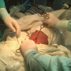 ВИДЕО (18+) - Кыргыз дарыгерлери коронавируска чалдыккан бейтапка операция жасаганын көрсөтүштү
