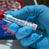 COVID-19: Өлкө аймагында акыркы бир суткада 556 адамдан коронавирус аныкталды