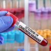 ВОЗ считает омикрон-штамм коронавируса менее опасным, чем дельта