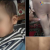 ФОТО - В Ошской области избили 3-летнего ребёнка