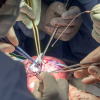 ВИДЕО - Дүйнөдө биринчи жолу түйүлдүккө операция жасалды