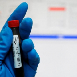 ВАДА похвалило Путина за признание провала в борьбе с допингом