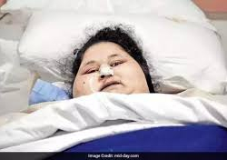 Самая тяжелая женщина в мире станцевала после операции