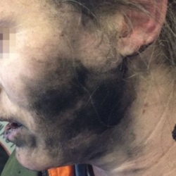 У летевшей в Мельбурн пассажирки взорвались наушники