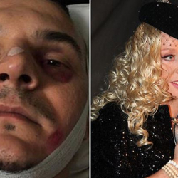 Врачи спасают лицо любимого композитора звезд эстрады