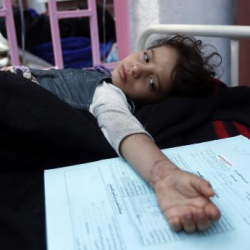 Йеменде холера эпидемиясы