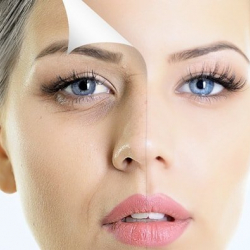 Ботокс организимге тийгизген терс таасирлерин билесизби?..