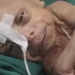 ФОТО - В Бангладеш родился мальчик-старик