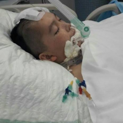 Москвада жандандыруу бөлүмүндө жаткан өспүрүм 3 жылдан бери оору менен күрөшүүдө 