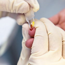 Почти у 20 детей из приюта в Одесской области подозревают гепатит