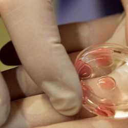 Гинеколог-репродуктолог 25 аялды эскертүүсүз уруктандырган