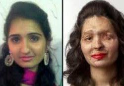 Эжеси менен сиңдисин алмаштырып алган кылмышкер сулуу кыздын жүзүн адам тааныгыс кылып өзгөртүп салды