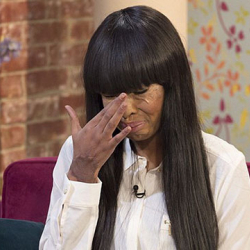 Модель курбусунун ийгиликтерин көрө албай жүзүнө кислота чачкан