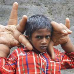 Алп манжалуу бала