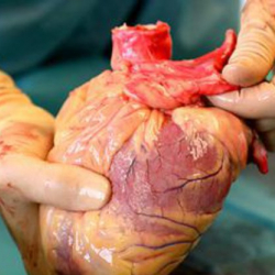 Под воздействием наркотиков мужчина сварил сердце своей девушки