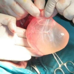 Аялына ойнош болгон агасынын жыныстык мүчөсүн кесип салган