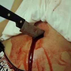 ГУВД: По факту нанесения ножевого ранения задержана женщина