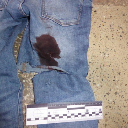 Пляжда досун бутка сайган жигит өч алууну көздөгөн