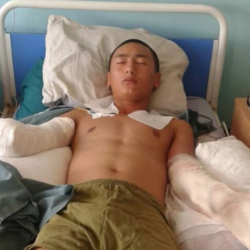 Дарыгер токко урунган жоокердин абалы тууралуу маалымат берди