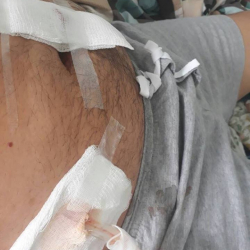 КСДПнын депутаты бирөөнү бычактады