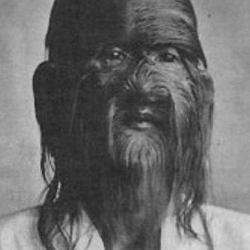 Жин оорусу менен ооруган адамдардын саны өсүп баратат