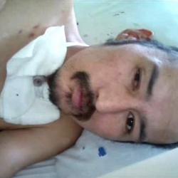 Москвадагы ооруканада оор абалда жаткан кыргызстандык кишинин иниси табылды