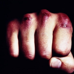 Көлдө эркекти адам тааныгыс кылып өлтүрүп кетишкен