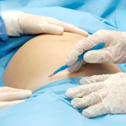 Мас абалындагы врач кош бойлуу айым менен анын наристесинин өмүрүн алды