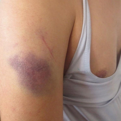 Абакта жаткан адам сабалды