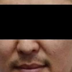 36 жаштагы тургундун тиштерин аттиш менен жулгандар колго түштү