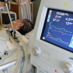 27 жылдан бери комада жаткан аял эсине келди