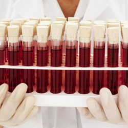 Окумуштуулар эң коркунучтуу кан тобун аныкташты