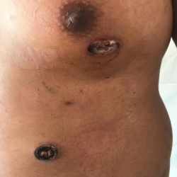 ФОТО - Көк-Жарда жаш жигитти атып кеткен кылмышкерлер изделүүдө