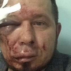 Архитекторду аёсуз сабап кетишти