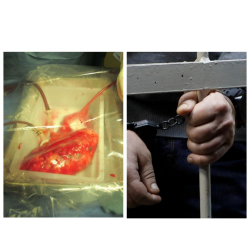 Адам органдарын сатып жүргөн кылмыштуу топ кармалды