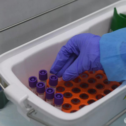 В Москве за сутки у 434 человек выявили коронавирус