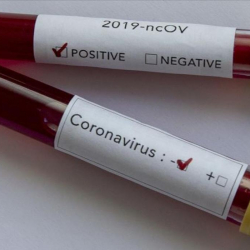 У матери с диагнозом Сovid-19 родился здоровый ребенок