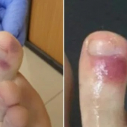 Буттардагы жагымсыз 