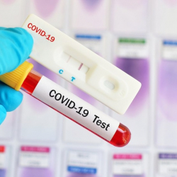 Кыргызстан коронавирустун күчөгөн маалына даярбы? Министрликтин жообу