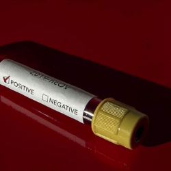 Ученые сообщили о возможной связи между нехваткой витамина D и высокой смертностью от Covid-19