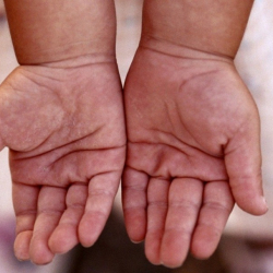 Бишкекте 1 жаштагы баланын колу темир капкактын тешигине кыпчылып калган