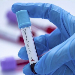 Түркмөнстандан коронавирус илдети чыкты