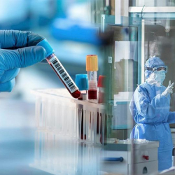 30-июнга карата Кыргызстанда коронавирус илдетин жуктургандардын саны өстү