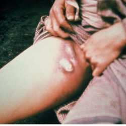 Монголиядагы чума дарты тездик менен Кытайга жетти