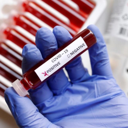 Коронавирустан дагы эки адам көз жумду