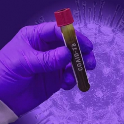 ВОЗ и Билл Гейтс предлагали взятки африканским странам: кто стоит за COVID-19 и кому это выгодно