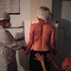 В Аксы мужчина жестоко избил супругу (фото)