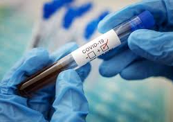 Акыркы суткада өлкөдө дагы 81 адамдан коронавирус аныкталды. Жалпы саны 45.416га жетти