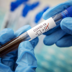 Акыркы сутка ичинде Covid-19 боюнча маалымат